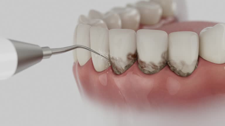 Reliable Dental Implants contractor in Golden Beach, MD by Smile Center Dentistry